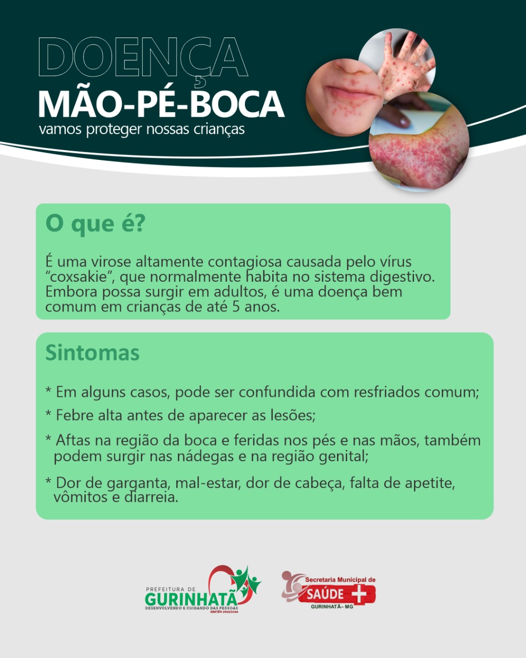 Doença mão-pé-boca, veja os cuidados. – Prefeitura Municipal de Gurinhatã
